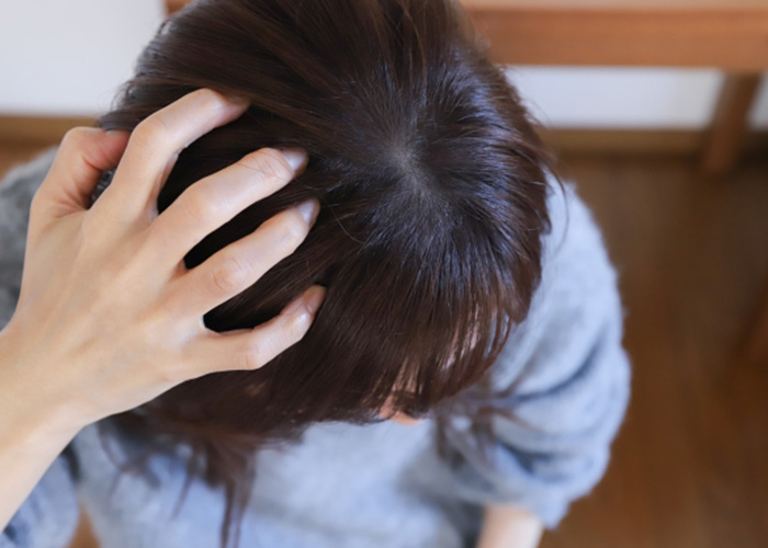 女性のうす毛