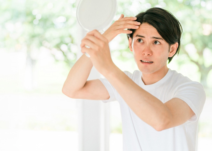 男性型脱毛症